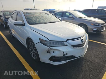 2015 Acura TLX – miniatura 3