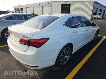 2015 Acura TLX – miniatura 4