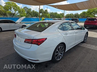 2016 Acura TLX w/Technology Pkg – miniatura 4