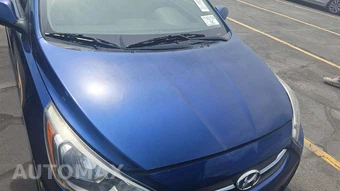 2016 Hyundai Accent SE Hatchback - miniatura 45