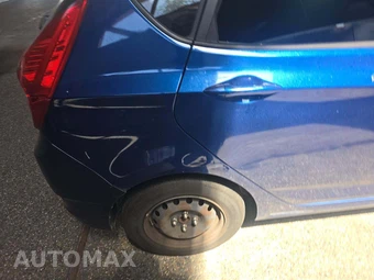 2016 Hyundai Accent SE Hatchback – miniatura 27
