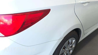 2016 Hyundai Accent SE Sedan - miniatura 35