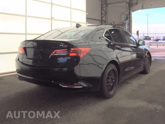 2017 Acura TLX – miniatura 4