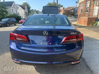 2017 Acura TLX w/Technology Pkg – miniatura 4