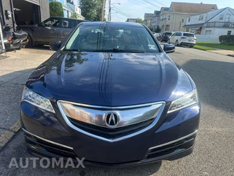 2017 Acura TLX w/Technology Pkg – miniatura 8