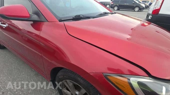 2017 Hyundai Elantra SE Sedan – miniatura 30