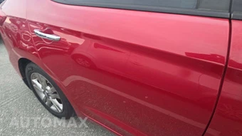 2017 Hyundai Elantra SE Sedan – miniatura 31