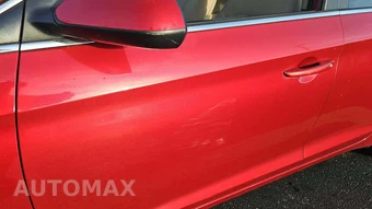2017 Hyundai Sonata SE – miniatura 26