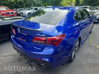 2018 Acura TLX w/Technology & A-Spec Pkgs - miniatura 4