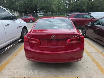 2018 Acura TLX w/Technology Pkg – miniatura 5