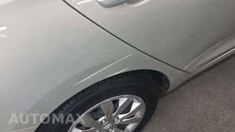 2018 Hyundai Accent SE – miniatura 23