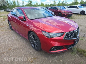 2020 Acura TLX w/Advance Pkg – miniatura 4