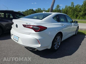 2023 Acura TLX – miniatura 3