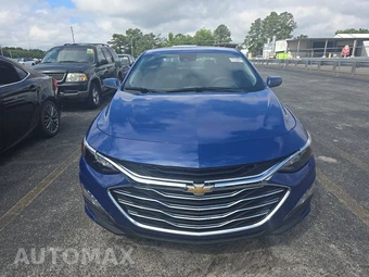 2023 Chevrolet Malibu LT 1LT – miniatura 2