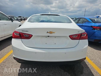 2024 Chevrolet Malibu LT 1LT – miniatura 5