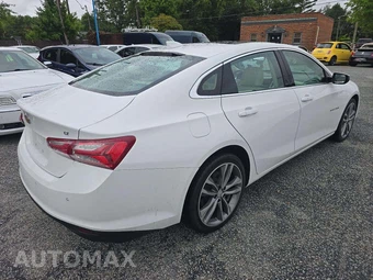 2024 Chevrolet Malibu LT 2LT – miniatura 3