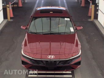 2025 Hyundai Elantra SEL Convenience - miniatura 2