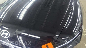 2025 Hyundai Sonata SEL – miniatura 35